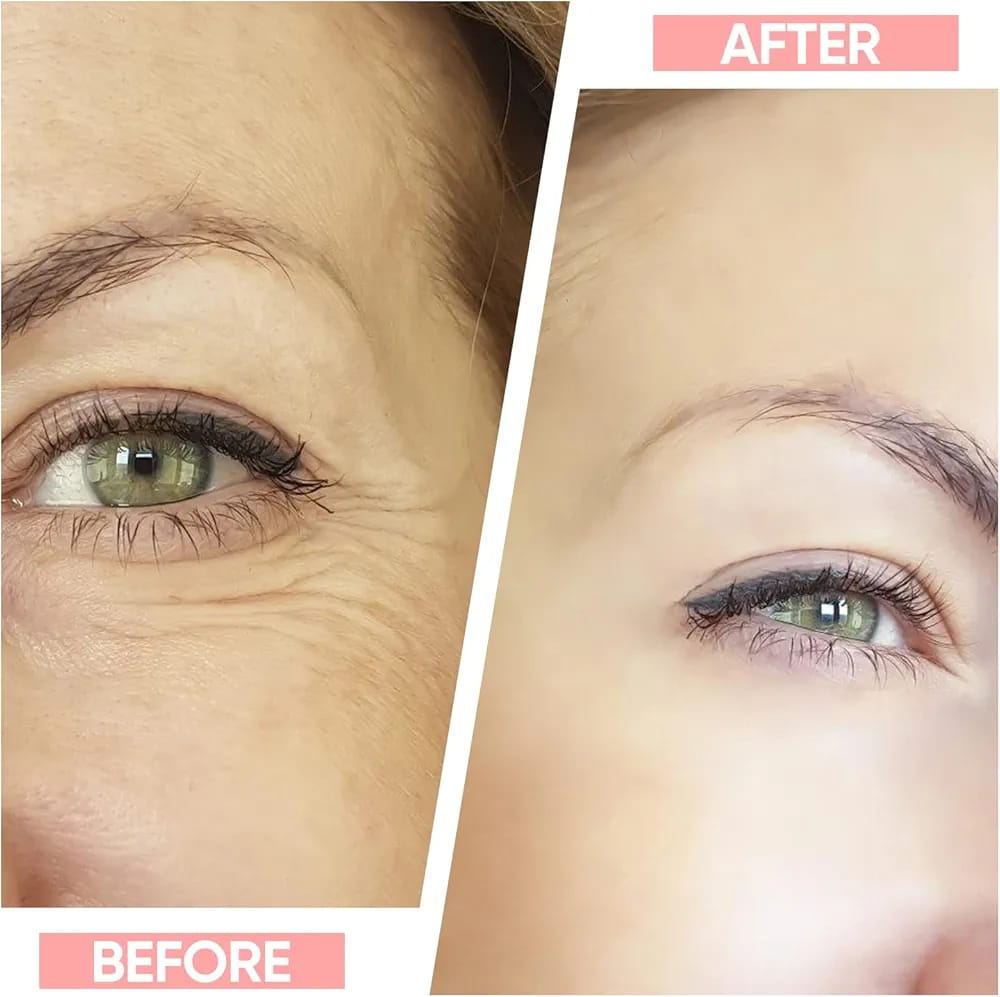 Neck & Face Wrinkle Remover