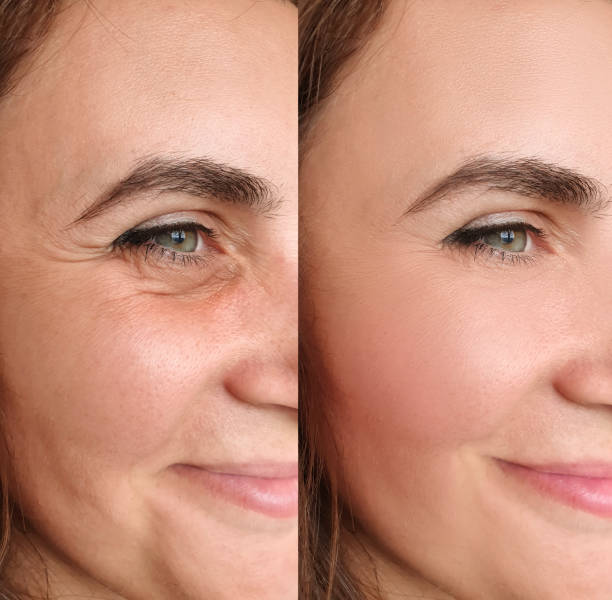 Look 10 Years Younger in Minutes - No Clinic Needed