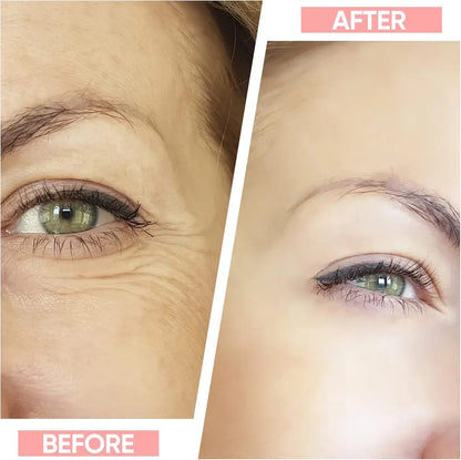 Neck &amp; Face Wrinkle Remover