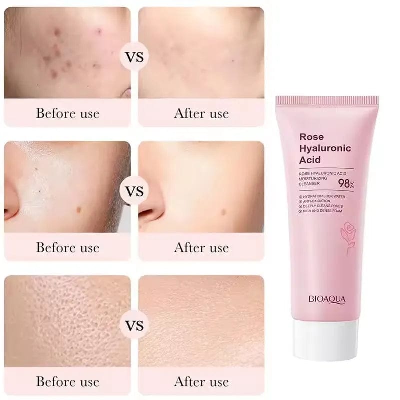 Rose Hyaluronic Acid Cleanser