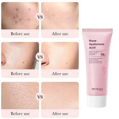 Rose Hyaluronic Acid Cleanser